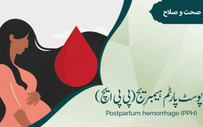 پوسٹ پارٹم ہیمریج (پی پی ایچ)(Postpartum hemorrhage (PPH